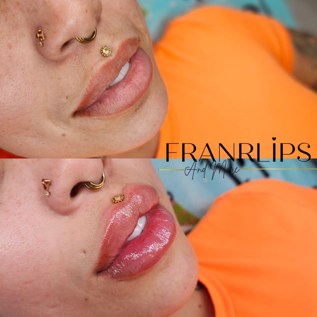 3D Kiss Lips (2ml)