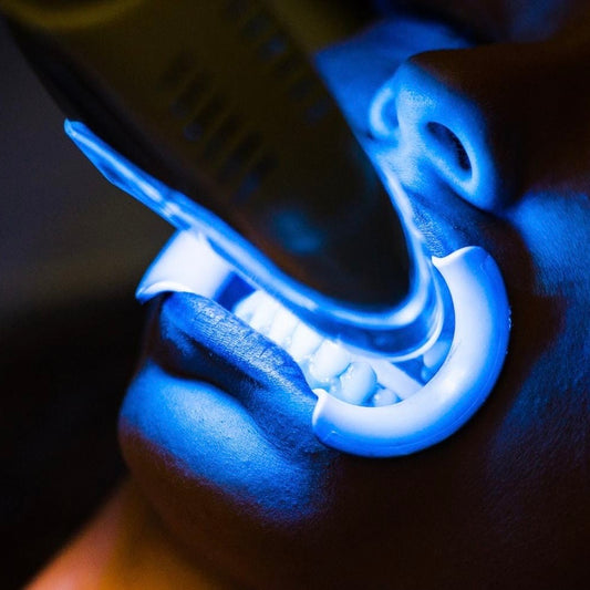 Blanqueamiento Dental (5 Secciones)